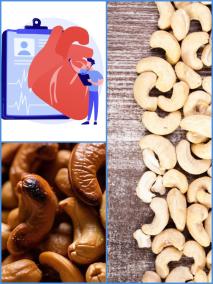 benefits-of-cashews