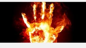 denial-of-love-proposal-youth-immolates-himself