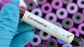 corono-virus-covid-19-johns-hopkins-university-guide-lines