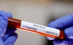 24-year-old-tests-positive-for-corona-virus-in-tirupur