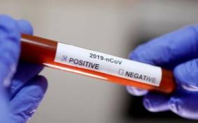 prisoner-tests-positive-for-corona-virus
