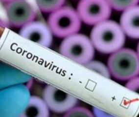 380-persons-tests-positive-for-corona-virus-in-puduchery-today