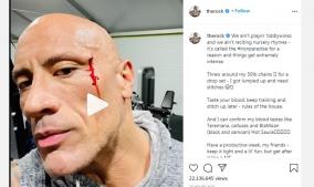 dwayne-johnson-injures-face-while-working-out