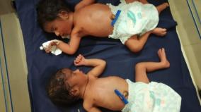 twin-babies-for-covid-19-positive-woman