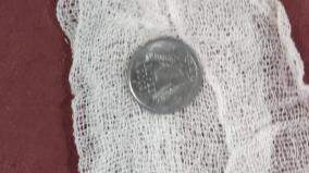 one-rupee-coin-struck-in-boy-throat