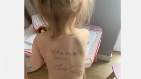 ukrainian-mother-writes-family-details-on-toddler-s-back