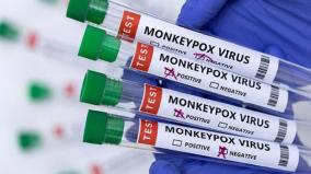 how-is-monkeypox-transmitted-a-quick-look-at-vaccines-and-modern-treatments