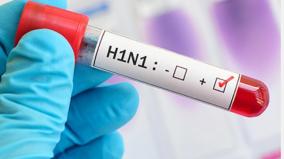 health-department-plans-to-buy-6000-h1n1-test-kits-in-15-days