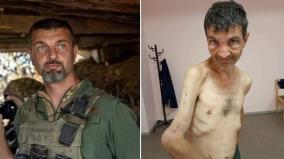 ukraine-releases-shocking-before-and-after-pictures-of-soldier