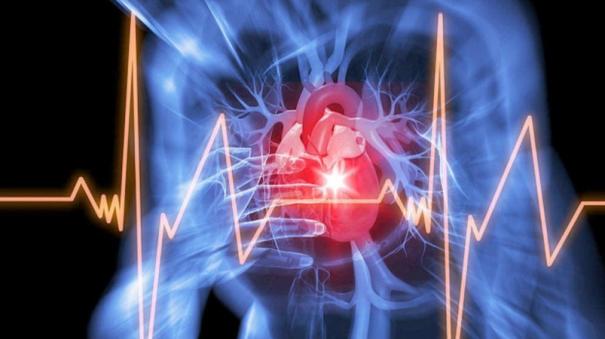 आर्टिफिशियल इंटेलिजेंस तकनीक 10 साल पहले दिल के दौरे का पता लगा सकती है