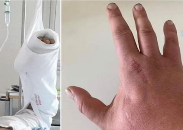 டென்மார்க் | 4 ஆண்டுகளுக்கு முன்னர் விரலை கடித்த பூனை: சதையை உண்ணும் பாக்டீரியா பாதிப்பால் ஒருவர் பலி