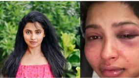 malayalam-actor-anicka-vikhraman-accuses-ex-anoop-pillai-of-assaulting-her