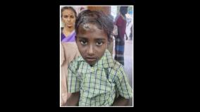 thanjavur-a-school-student-was-injured-when-the-roof-of-a-school-fell-in-parthikudi