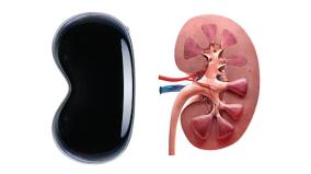 two-kidneys-are-not-enough