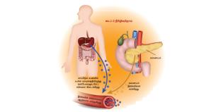 no-5-for-diseases-diabetes-proper-treatment-is-essential