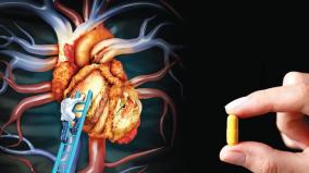is-a-pill-enough-to-lower-cholesterol
