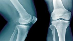 new-discovery-in-bone-research