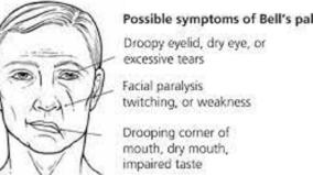 how-to-prevent-bell-s-palsy-caused-by-excessive-snow-physiotherapy-doctor-explanation