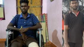negligence-of-electricity-board-villupuram-youth-lost-legs-due-to-electrocution