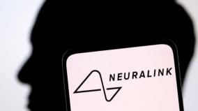 chip-in-human-brain-neuralink-approval-for-second-person