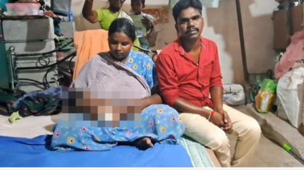 A 25-day-old baby was bitten by a monkey near Cuddalore