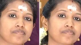 female-govt-doctor-committed-suicide-on-family-dispute-near-chinnamanur
