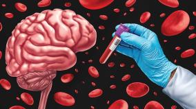 blood-test-for-alzheimer