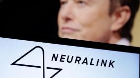 neuralink-implanted-brain-chip-to-second-person-elon-musk