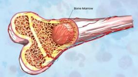 when-will-bone-marrow-transplants-become-available-to-everyone