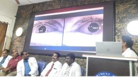 vertigo-laboratory-was-opened-at-madurai-government-hospital