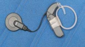 cochlear-implants-are-provided-free-for-deaf-children