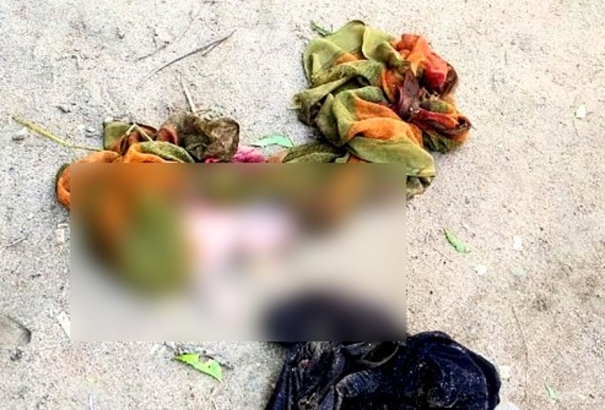 an-infant-thrown-away-on-the-roadside-has-been-bitten-by-dogs-near-usilampatti