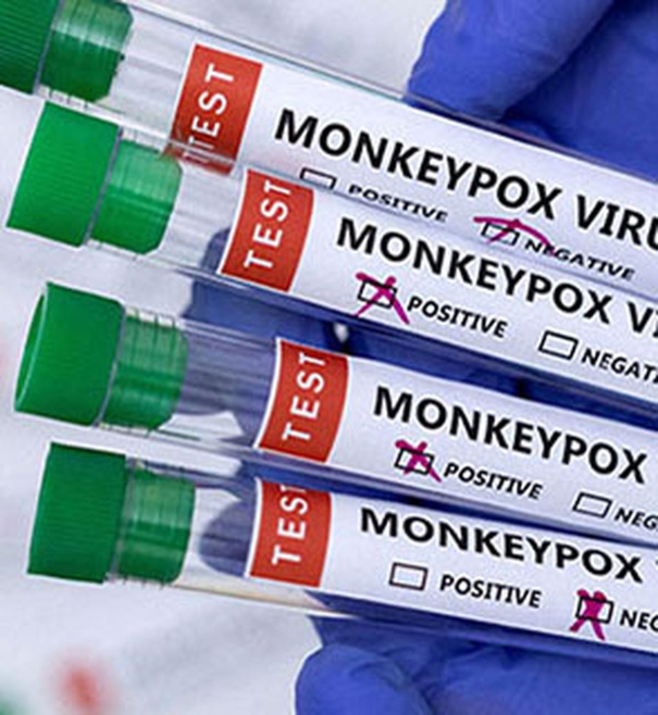 first-trial-of-antiviral-monkeypox-begins-in-britain