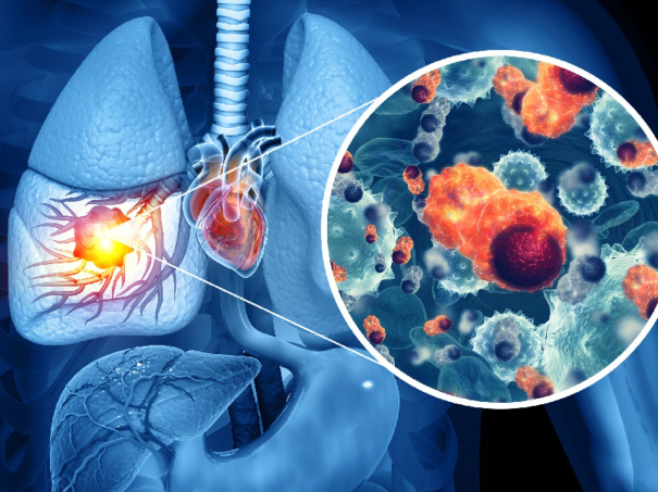 england-to-rollout-world-first-7-minute-cancer-treatment-jab