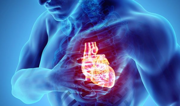 heart-attack-deaths-increased-sharply-in-2022