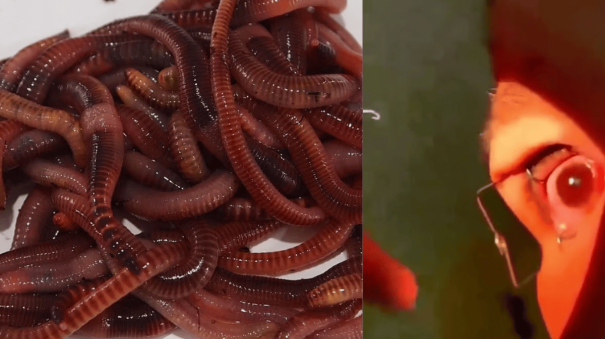 live-worms-found-in-chinese-woman-eyes