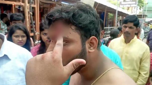 attack-on-north-state-youth-in-rameswaram-temple-complaint-against-temple-employee